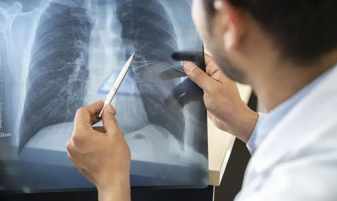 Anvisa aprova novo medicamento para câncer de pulmão avançado